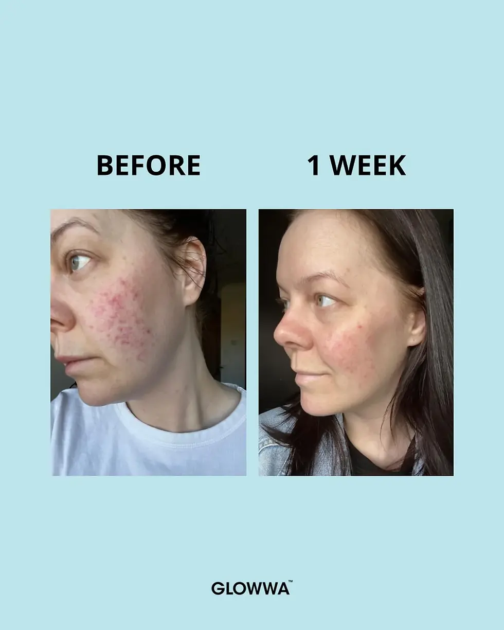 Thumbnail: GLOWWA COLLAGEN CREAMER - 1 Month Supply