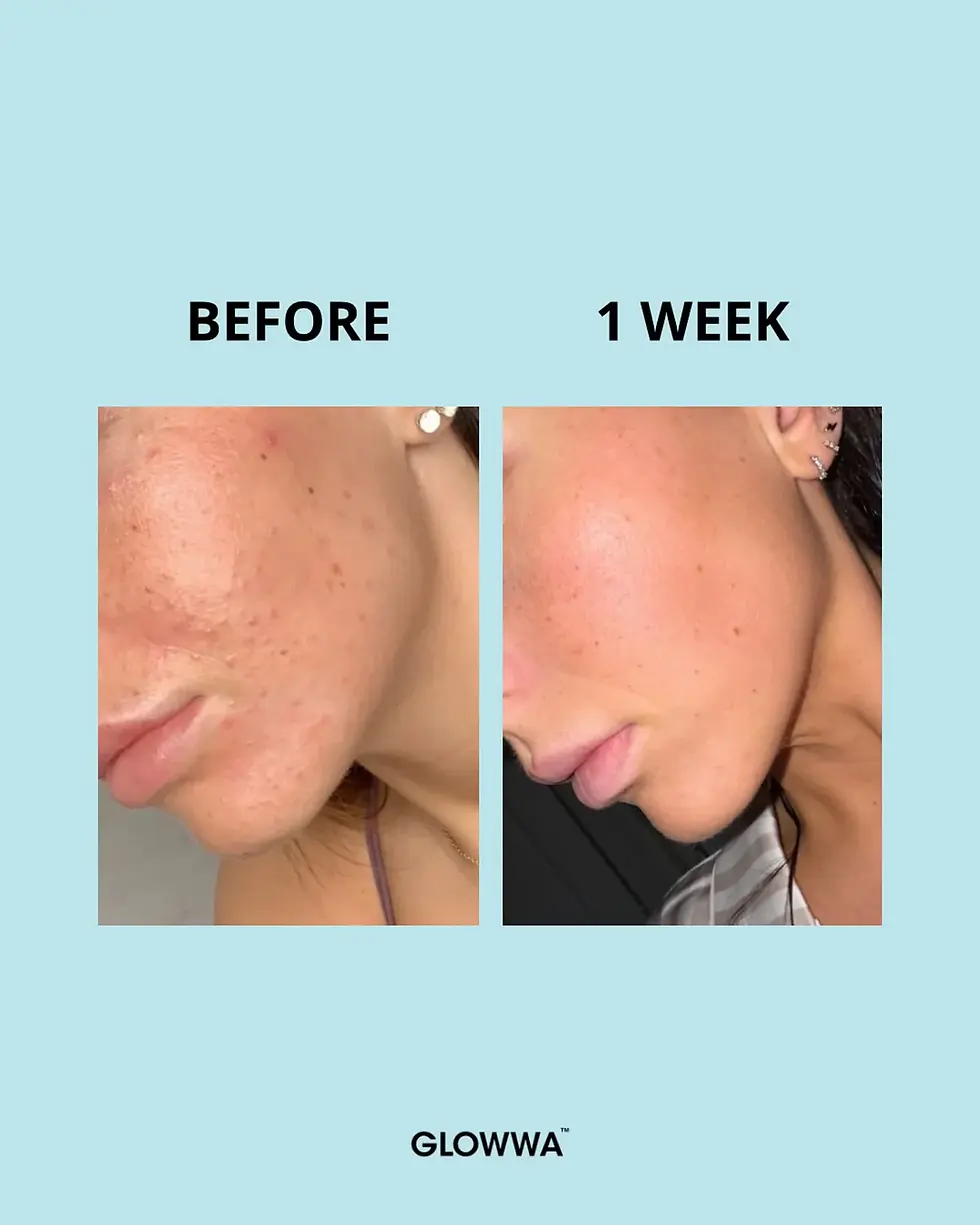 Thumbnail: GLOWWA COLLAGEN CREAMER - 1 Month Supply