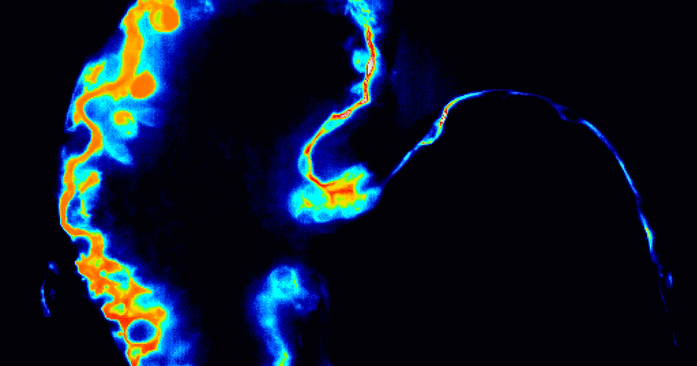 IMAGE3_Whole Heart-single slice thermal - small.tif