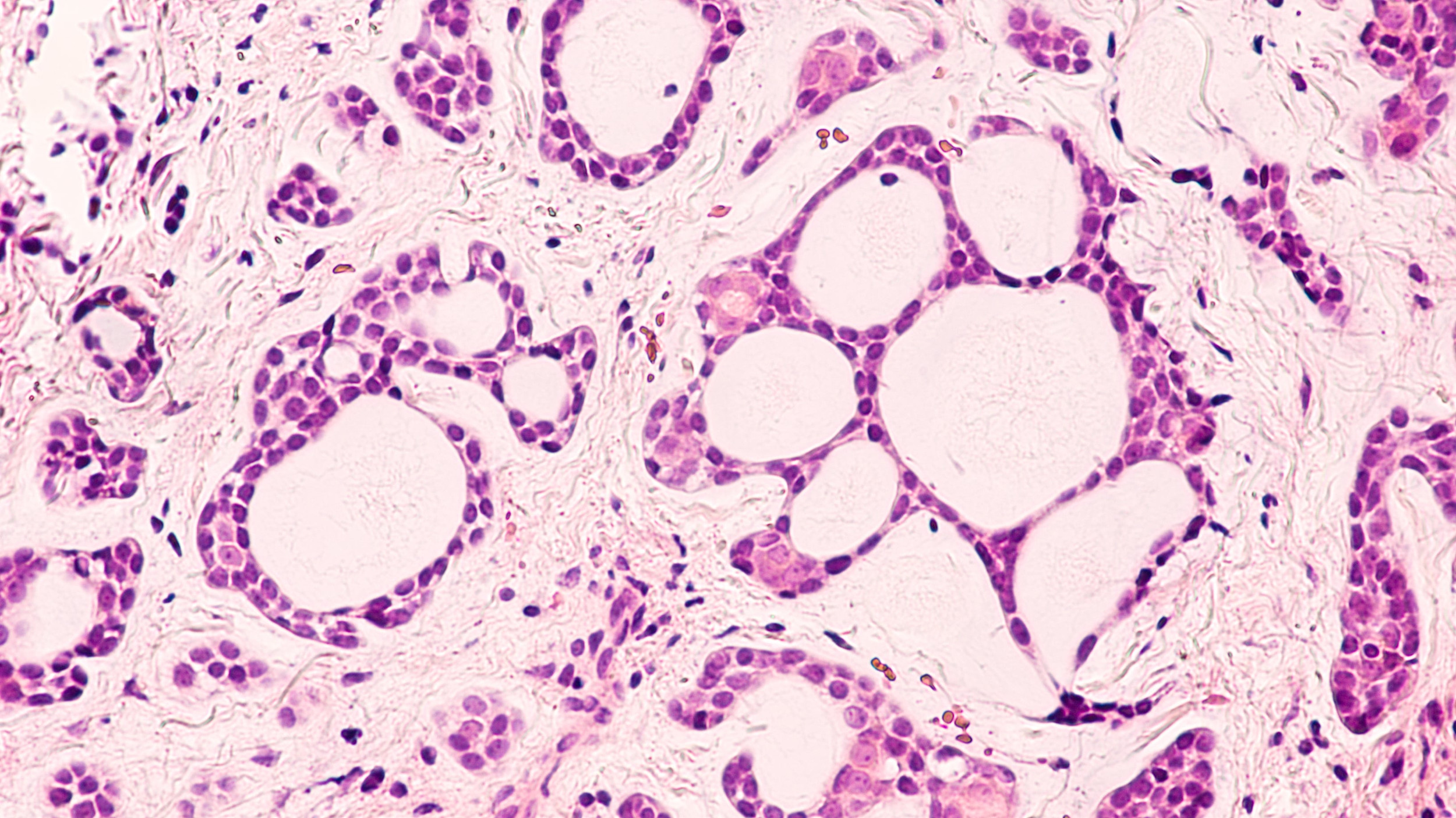 Salivary gland cancer: Causes, symptoms and treatment