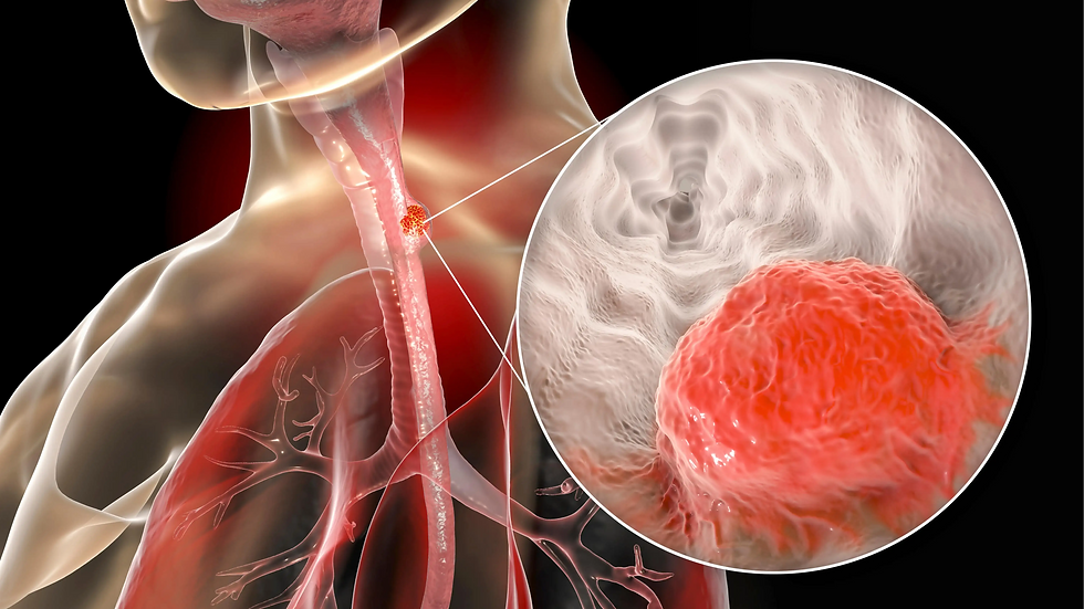 Esophageal_Cancer_Hyperthermia_Centre_Hannover.webp