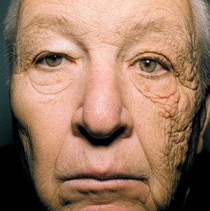 Het énige product dat écht werkt tegen rimpels!