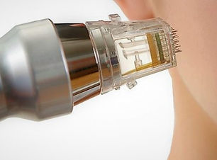 Microneedling 1.jpg