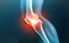 Pain around kneecap 2.jpg