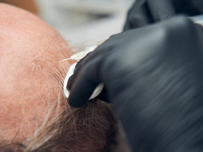 Endless Hair Problem: Your Daily Kopitiam Meal Swaps to Reverse Thinning, Flexing Thicker And Healthier Hair