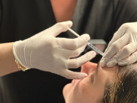 Botox Virgin? Here's Everything You Need To Know Before Your First Appointment