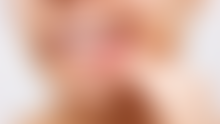 No More Receding Gums: Essential Oils for Gums That Heal Mouth Ulcers