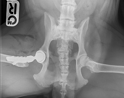 total hip replacement surgery