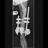 vet orthopaedic referral fracture surgery