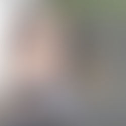 Ko dar nežinojote apie kolageną