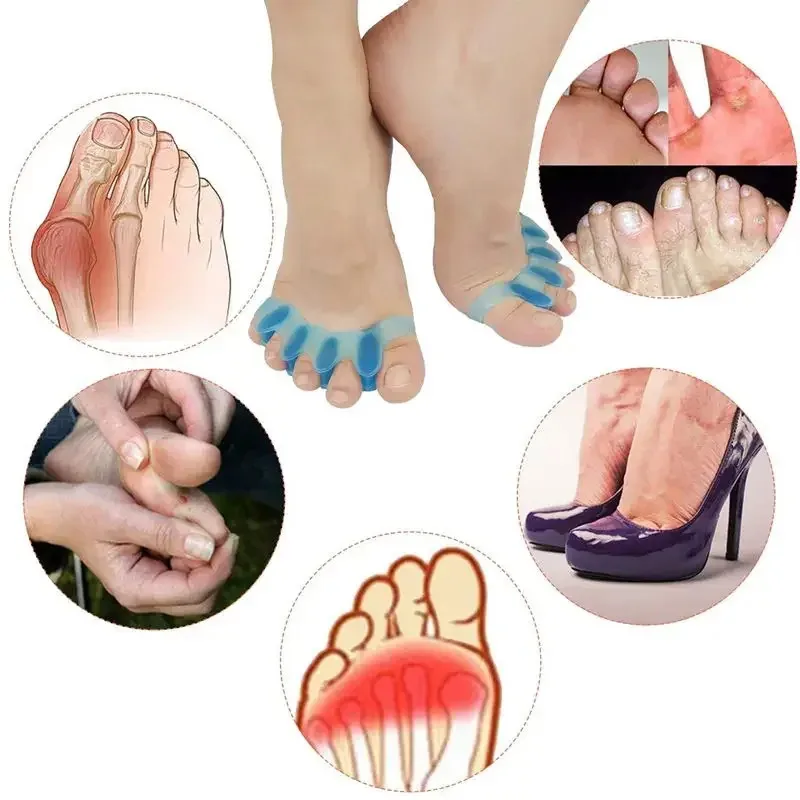 Thumbnail: Runner Recovery Toe Spacers™