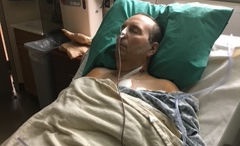 After Surgery