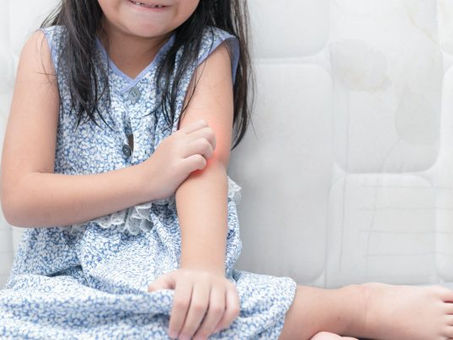 Alergias na Infância