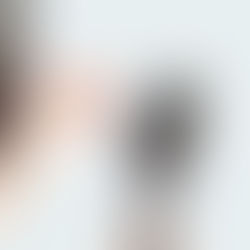 Estresse x Queda de cabelo: pior momento da pandemia até agora pode ser um dos motivos da alteração 