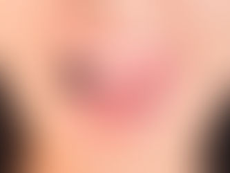 Conheça riscos de piercing para saúde bucal