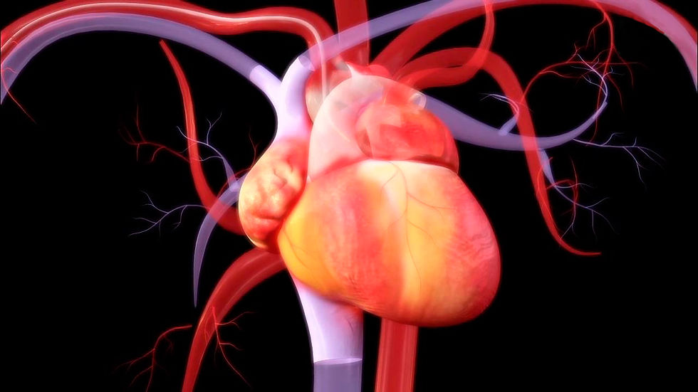Angioplastia Cerebral