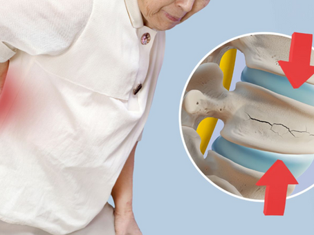 Is a Vertebral Compression Fracture an Emergency?