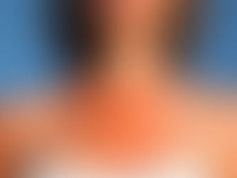 So You Got a Bad Sunburn—Are You Doomed to Get Skin Cancer?