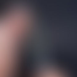 What Makes Poly-Lactic Acid Injections the Future of Facial Rejuvenation