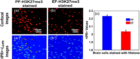 Histone molecular specific structural disorder by confocal IPR.png