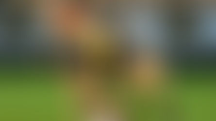 Kako prepoznati i liječiti ozljedu prednjeg križnog ligamenta (ACL)