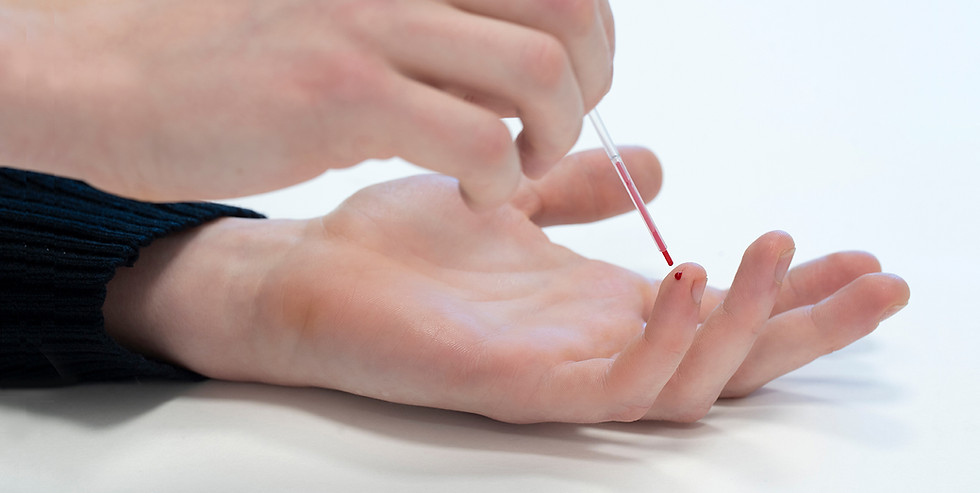 01.03.26 Hånd med pipette 72 dpi.jpg