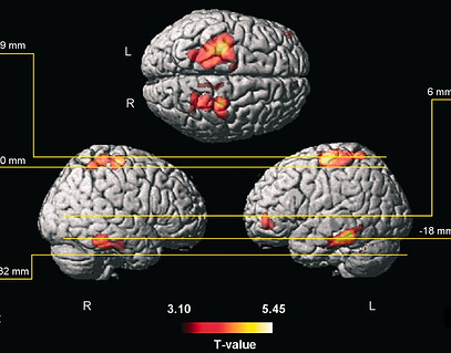 brain growth.jpg