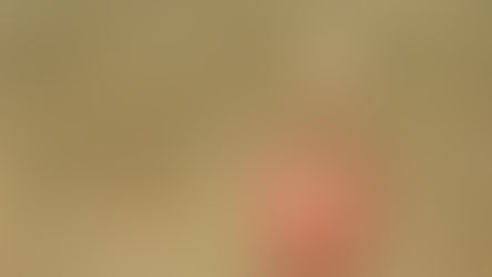 Bergamalı Galen’in Büyülü Bisturisi