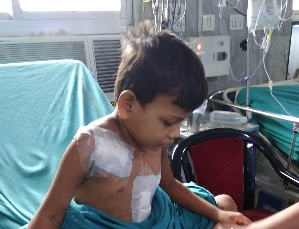 Trans-venous pacing followed by thoracotomy for removal of infected previous pulse generator, decortication of left lung, and removal of infected leads