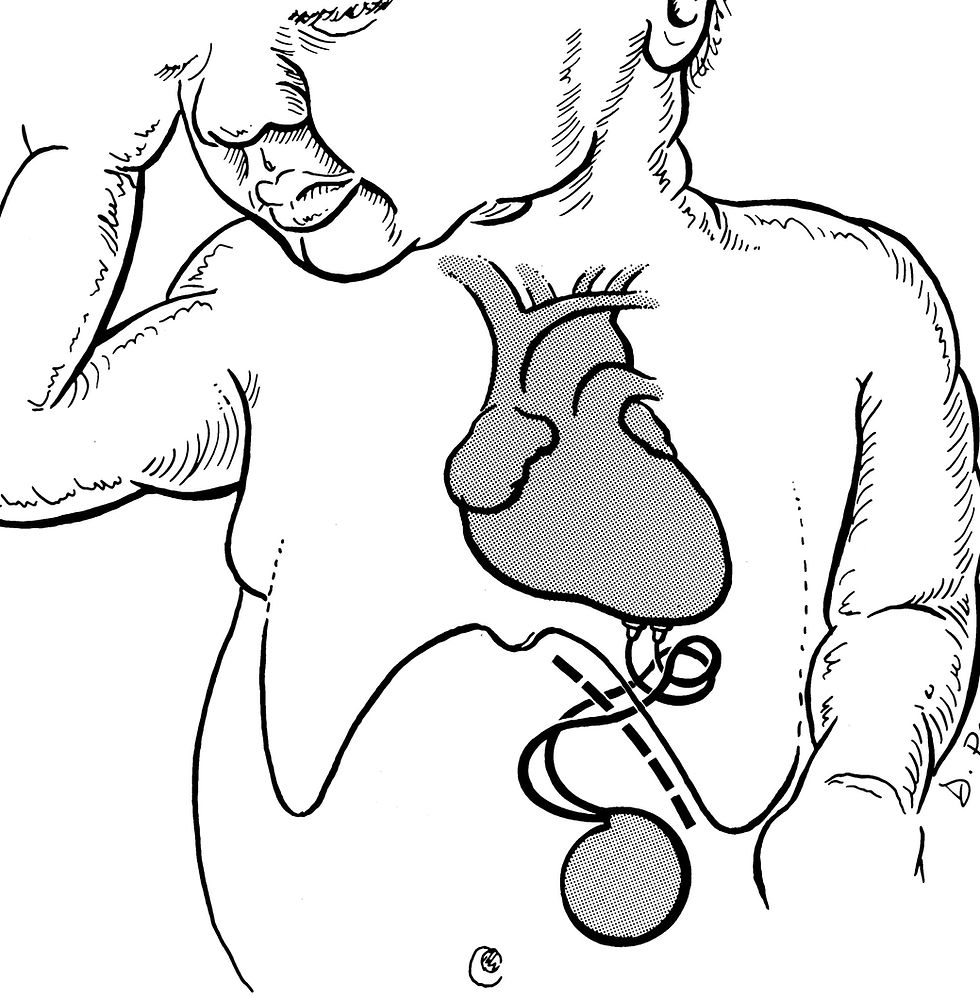 Neonatal epicardial pacing scheme