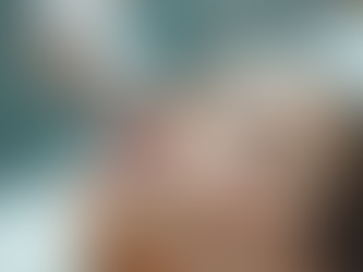 Top Microneedling Advantages: Unlock Radiant Skin with This Advanced Treatment