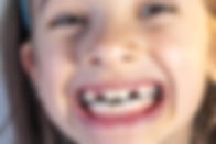 melbourne orthodontist early intervention