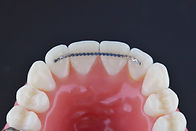 happy teenager with orthodontic retainers