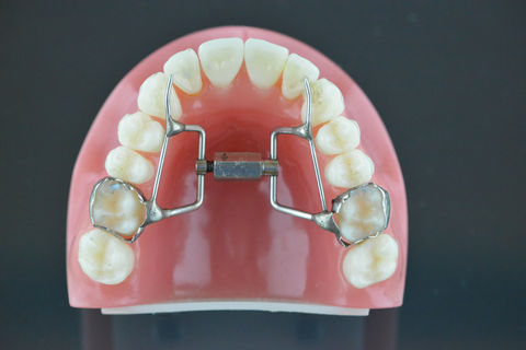 Fan Expander melbourne ortho