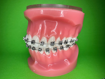 self ligating braces melbourne ortho