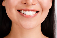 facemask therapy by melbourne orthodontist
