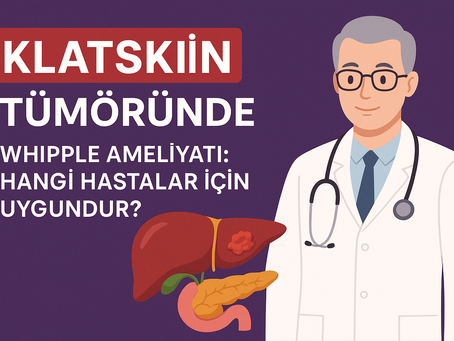 Klatskin Tümöründe Whipple Ameliyatı: Hangi Hastalar İçin Uygundur?