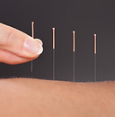 acupuncture-close-up-e1549903798107.jpeg