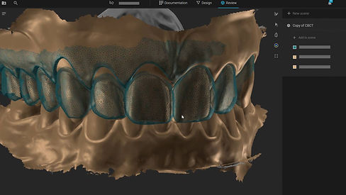 дигитално планиране смайл дизайм smile disign smilecloud смайлклауд