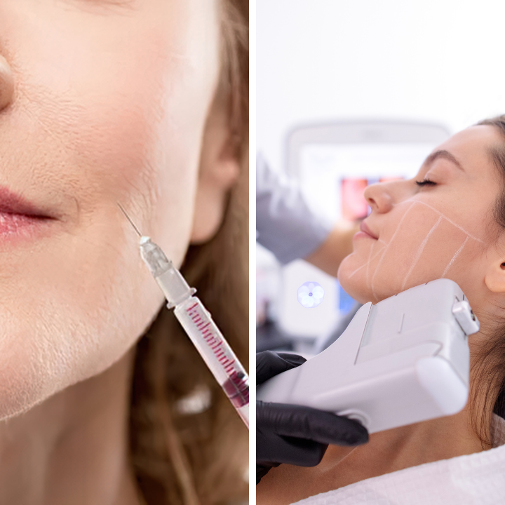 HIFU vs Botox — Quelle est la meilleure technique pour rajeunir sans chirurgie ?