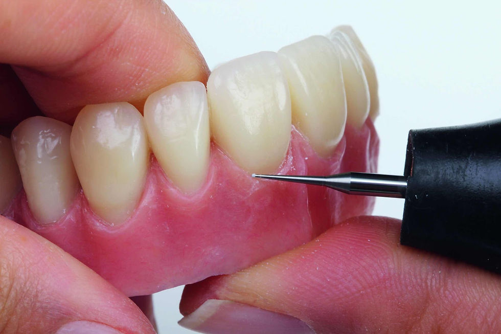 protesis_dental_alicante3.jpg