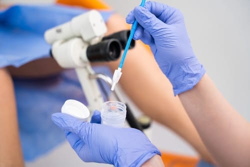 Teste de DNA é aliado para detectar HPV e pode substituir papanicolau