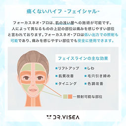 HIFE（ハイフ） | いわもん鍼灸整骨院