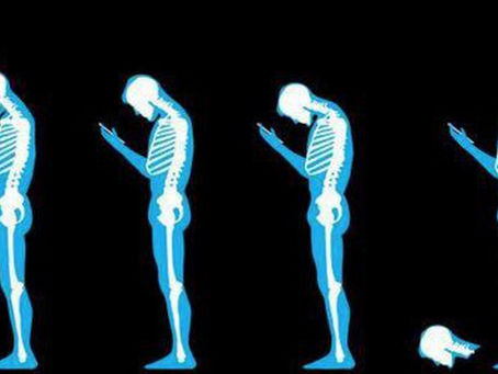 Text Neck? ..... You Must Be Joking!