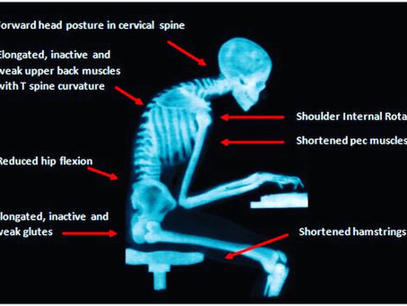 How to look after your body whilst working at your desk....