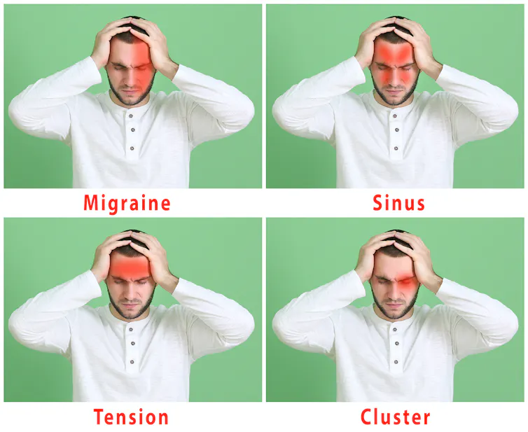 Four most common types of headache, Migraine, Sinus, Tension and Cluster