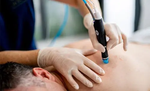 hydrafacial-back-treatment-york-leeds-yorkshire-coppergate-clinic.webp