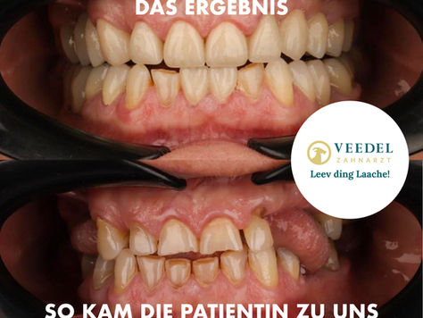 Lieber spät als nie ...