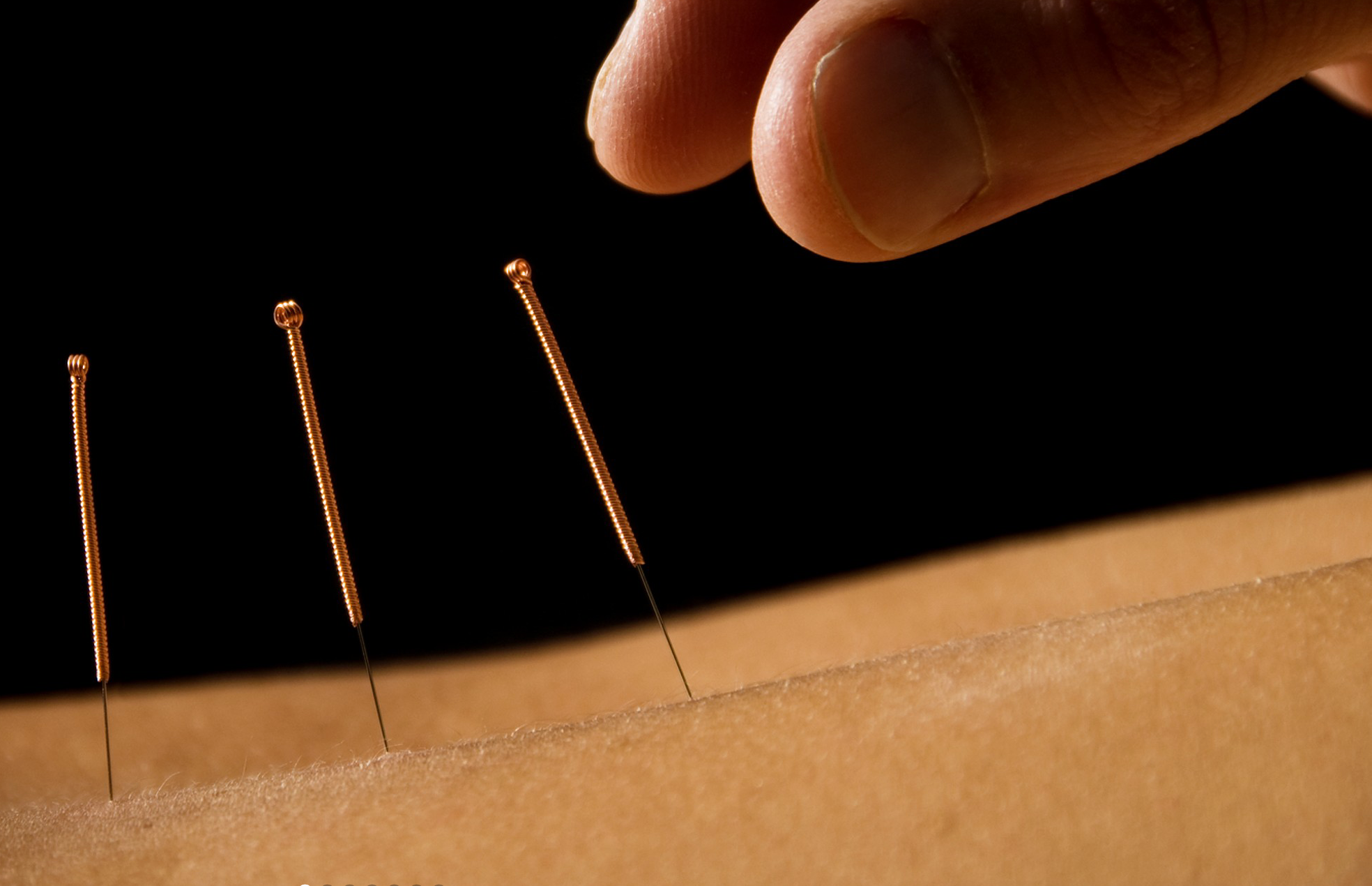 Gutschein für eine TCM-Behandlung