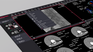 Implementing & Evaluation AI in Radiology. Learn from radiologists how they navigate clinical AI selection.